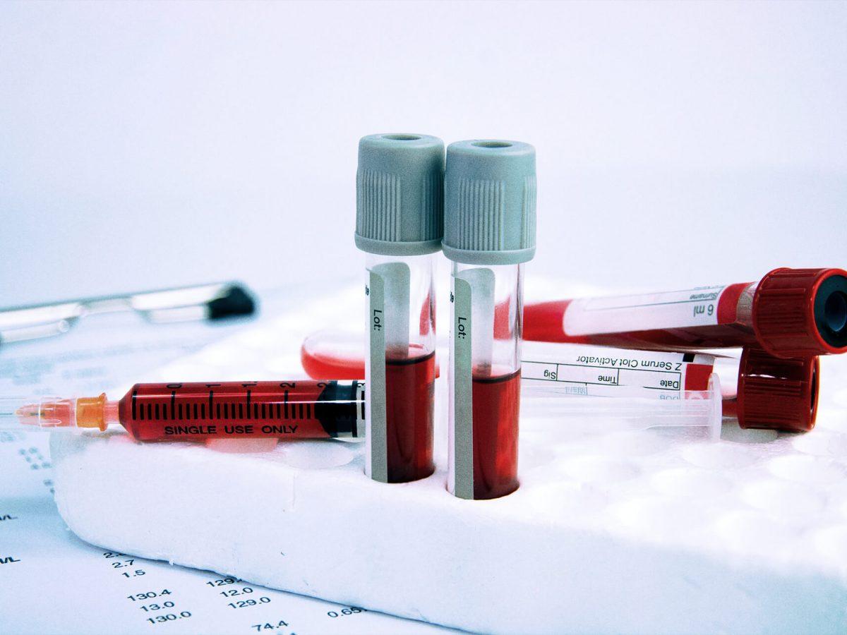 Аналізи крові в місті Біла Церква: Якість та зручність у лабораторії CentroLab